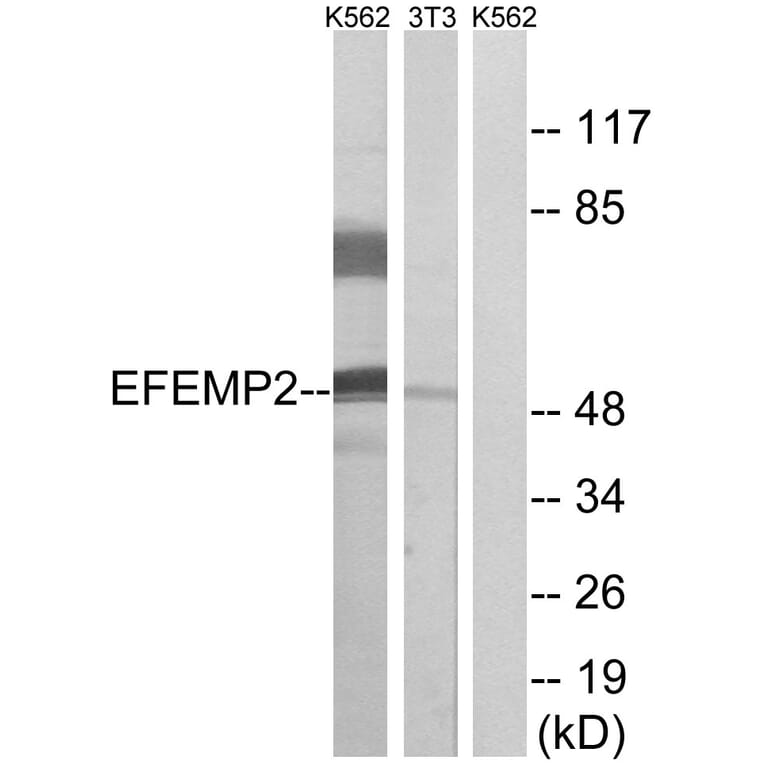 Western Blot - Anti-EFEMP2 Antibody (C15602) - Antibodies.com