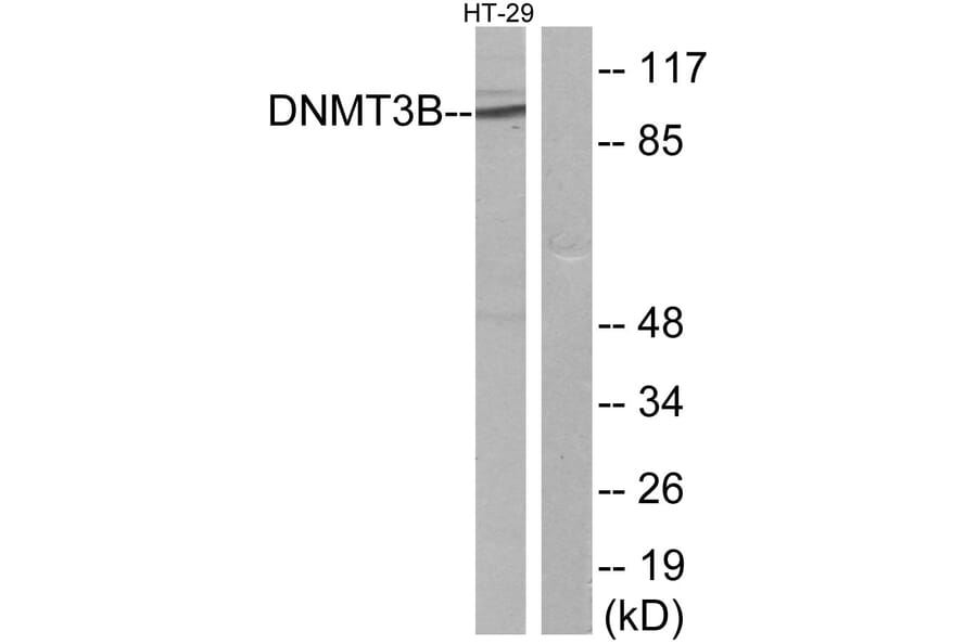 Western Blot - Anti-DNMT3B Antibody (C11809) - Antibodies.com
