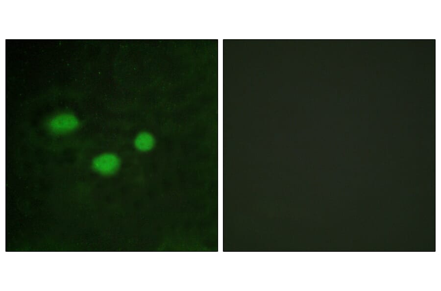 Immunofluorescence - Anti-DNMT3B Antibody (C11809) - Antibodies.com