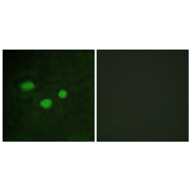 Immunofluorescence - Anti-DNMT3B Antibody (C11809) - Antibodies.com