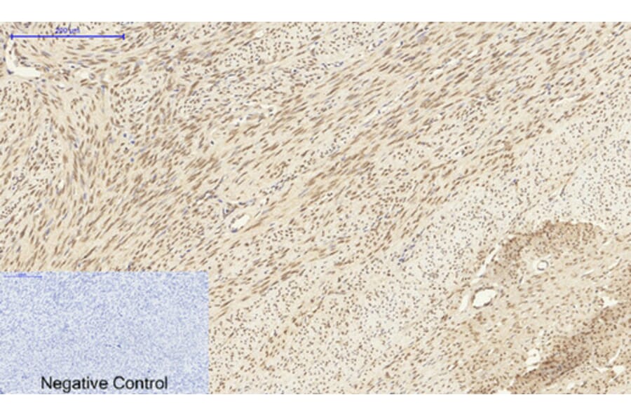 Immunohistochemistry - Anti-DNMT3B Antibody (C11809) - Antibodies.com
