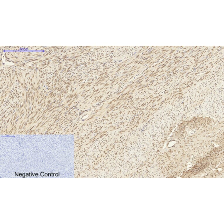 Immunohistochemistry - Anti-DNMT3B Antibody (C11809) - Antibodies.com