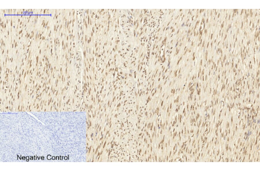 Immunohistochemistry - Anti-DNMT3B Antibody (C11809) - Antibodies.com