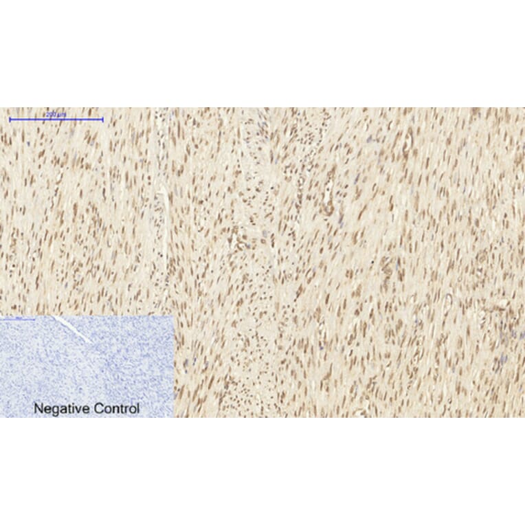 Immunohistochemistry - Anti-DNMT3B Antibody (C11809) - Antibodies.com