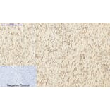 Immunohistochemistry - Anti-DNMT3B Antibody (C11809) - Antibodies.com