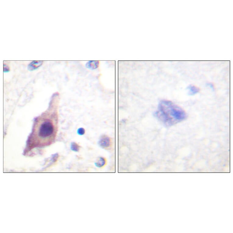 Immunohistochemistry - Anti-CDC25B Antibody (B0855) - Antibodies.com