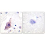 Immunohistochemistry - Anti-CDC25B Antibody (B0855) - Antibodies.com