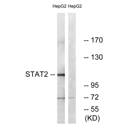 Western Blot - Anti-STAT2 Antibody (B0089) - Antibodies.com