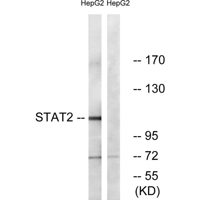 Western Blot - Anti-STAT2 Antibody (B0089) - Antibodies.com