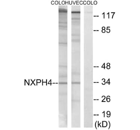 Western Blot - Anti-NXPH4 Antibody (C16918) - Antibodies.com