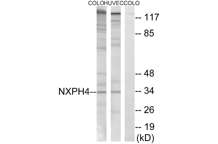 Western Blot - Anti-NXPH4 Antibody (C16918) - Antibodies.com