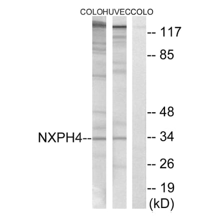 Western Blot - Anti-NXPH4 Antibody (C16918) - Antibodies.com