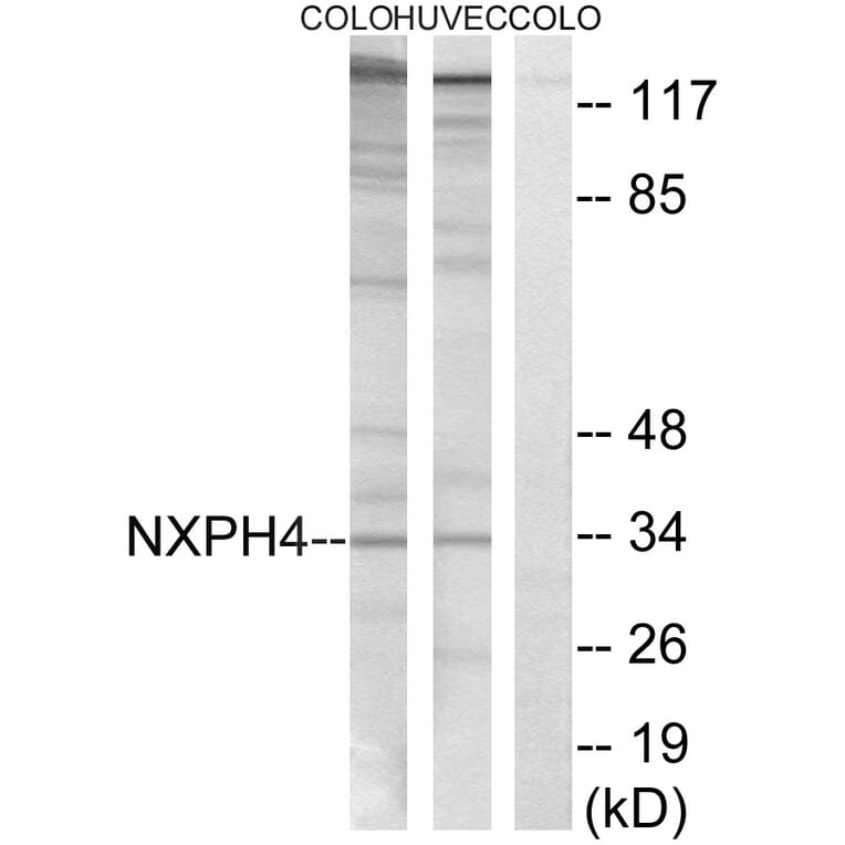 Western Blot - Anti-NXPH4 Antibody (C16918) - Antibodies.com