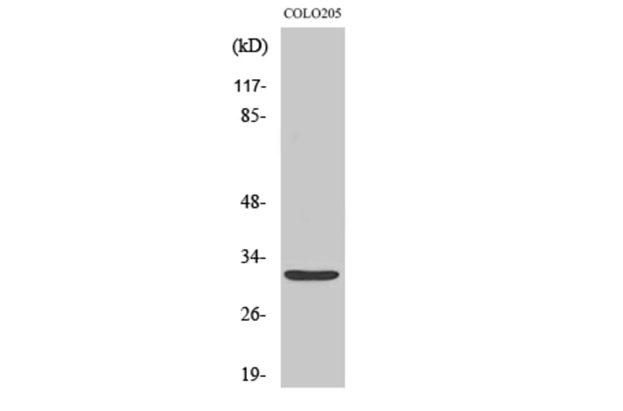 Western Blot - Anti-NXPH4 Antibody (C16918) - Antibodies.com