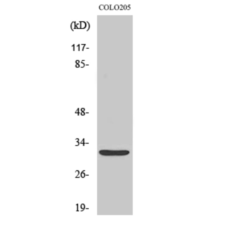 Western Blot - Anti-NXPH4 Antibody (C16918) - Antibodies.com