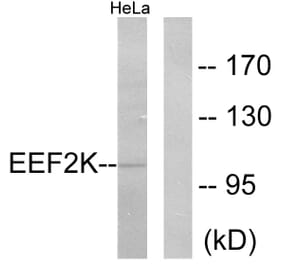 Western Blot - Anti-eEF2K Antibody (B0071) - Antibodies.com