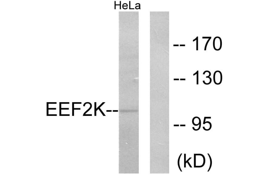 Western Blot - Anti-eEF2K Antibody (B0071) - Antibodies.com