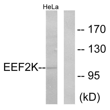 Western Blot - Anti-eEF2K Antibody (B0071) - Antibodies.com
