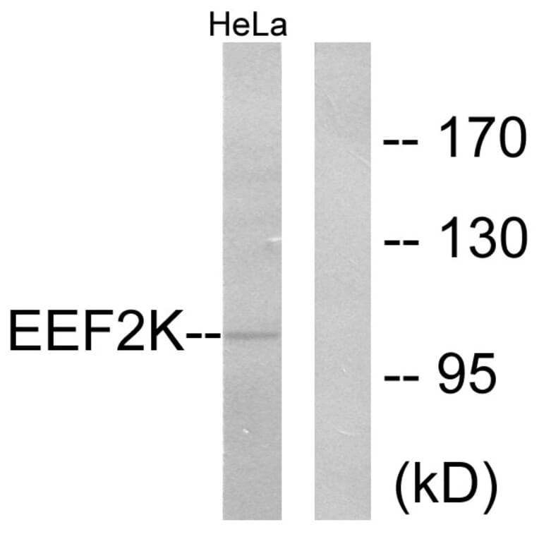 Western Blot - Anti-eEF2K Antibody (B0071) - Antibodies.com