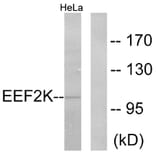 Western Blot - Anti-eEF2K Antibody (B0071) - Antibodies.com