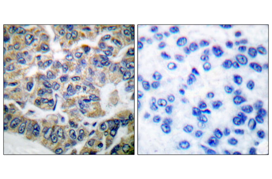 Immunohistochemistry - Anti-eEF2K Antibody (B0071) - Antibodies.com