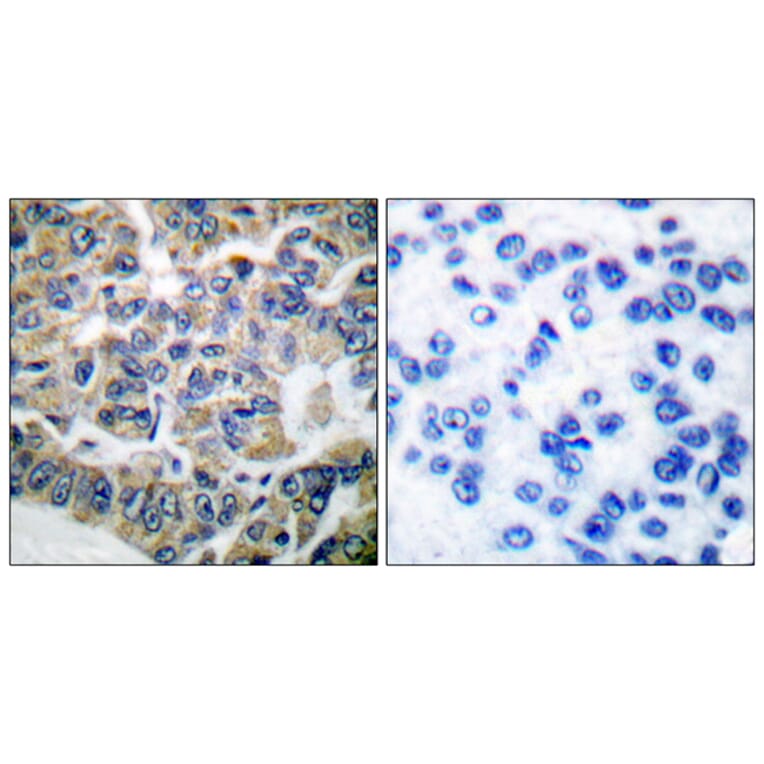 Immunohistochemistry - Anti-eEF2K Antibody (B0071) - Antibodies.com