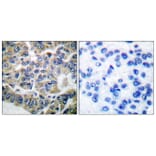 Immunohistochemistry - Anti-eEF2K Antibody (B0071) - Antibodies.com