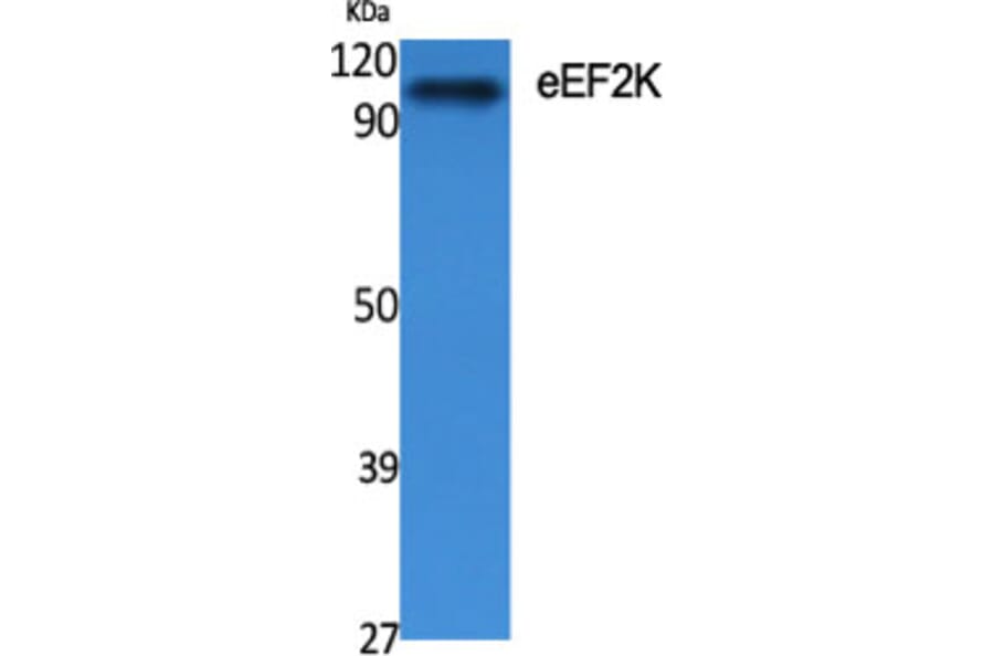 Western Blot - Anti-eEF2K Antibody (B0071) - Antibodies.com