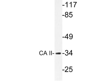 Western Blot - Anti-CA II Antibody (R12-2046) - Antibodies.com