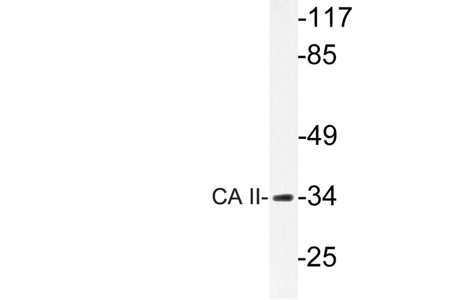 Western Blot - Anti-CA II Antibody (R12-2046) - Antibodies.com