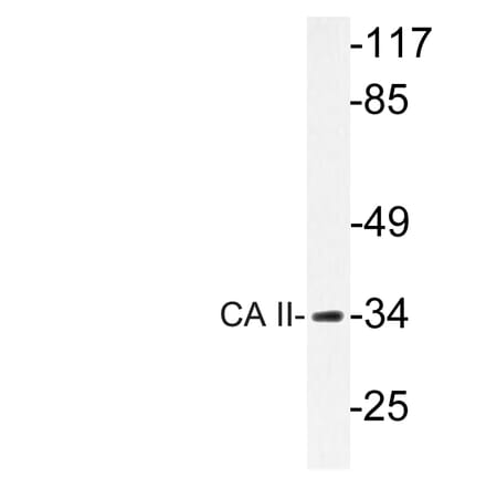 Western Blot - Anti-CA II Antibody (R12-2046) - Antibodies.com