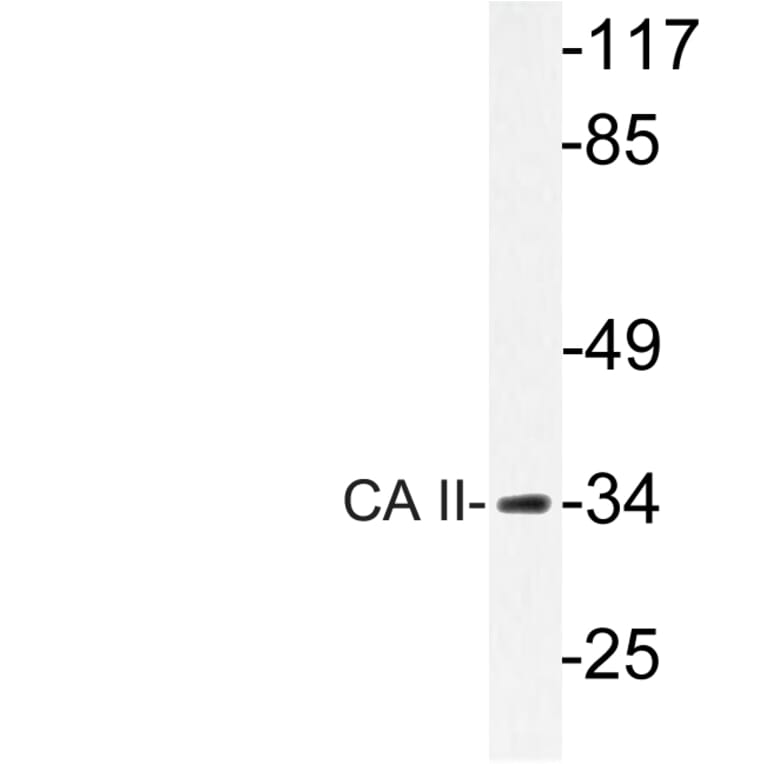 Western Blot - Anti-CA II Antibody (R12-2046) - Antibodies.com