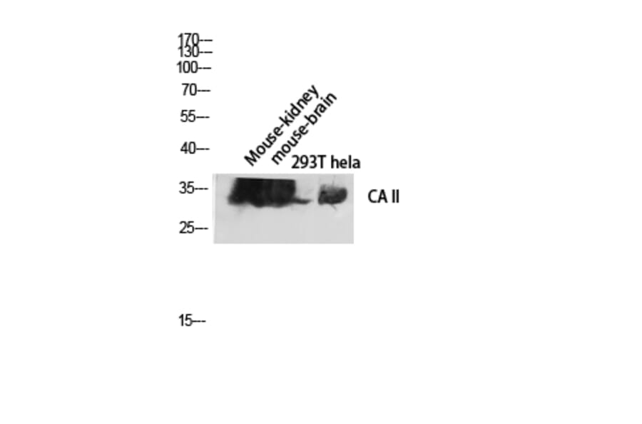 Western Blot - Anti-CA II Antibody (R12-2046) - Antibodies.com