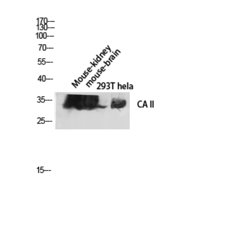 Western Blot - Anti-CA II Antibody (R12-2046) - Antibodies.com