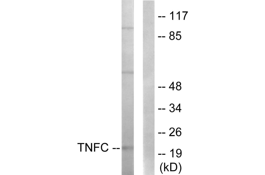 Western Blot - Anti-TNFC Antibody (C10895) - Antibodies.com
