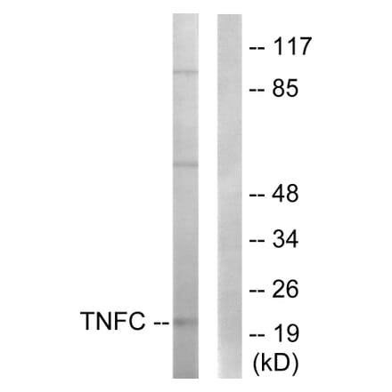 Western Blot - Anti-TNFC Antibody (C10895) - Antibodies.com