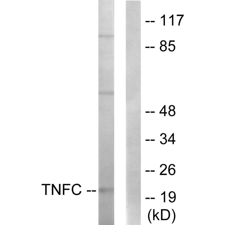 Western Blot - Anti-TNFC Antibody (C10895) - Antibodies.com