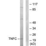 Western Blot - Anti-TNFC Antibody (C10895) - Antibodies.com