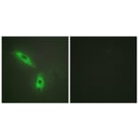 Immunofluorescence - Anti-TNFC Antibody (C10895) - Antibodies.com