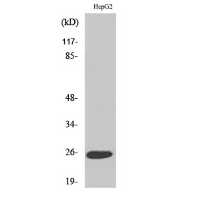 Western Blot - Anti-TNFC Antibody (C10895) - Antibodies.com