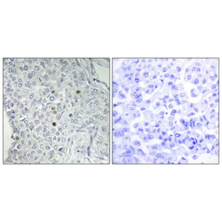 Immunohistochemistry - Anti-REQU Antibody (C11434) - Antibodies.com
