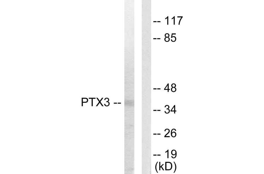 Western Blot - Anti-PTX3 Antibody (C10482) - Antibodies.com