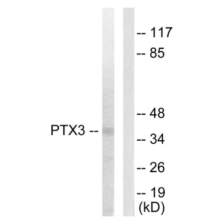 Western Blot - Anti-PTX3 Antibody (C10482) - Antibodies.com