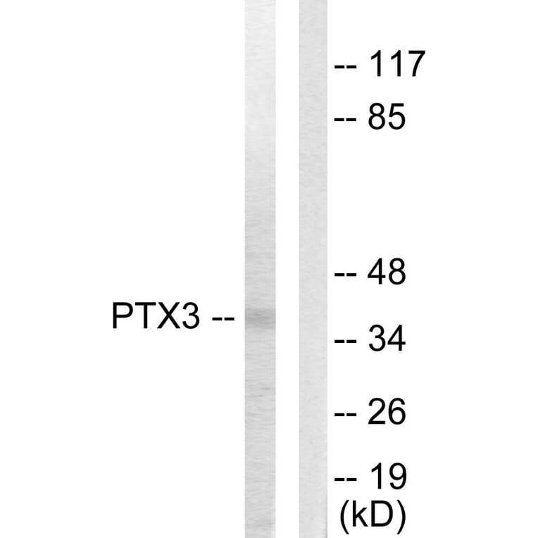Western Blot - Anti-PTX3 Antibody (C10482) - Antibodies.com