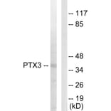 Western Blot - Anti-PTX3 Antibody (C10482) - Antibodies.com