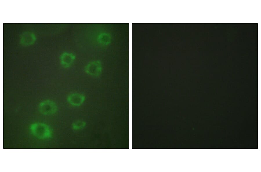 Immunofluorescence - Anti-PTX3 Antibody (C10482) - Antibodies.com