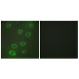 Immunofluorescence - Anti-PTX3 Antibody (C10482) - Antibodies.com