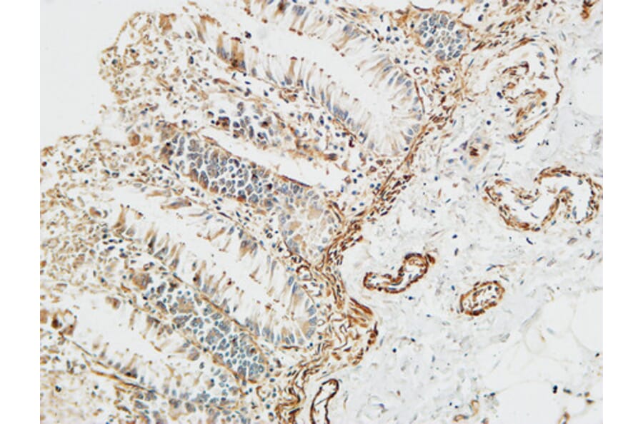 Immunohistochemistry - Anti-PTX3 Antibody (C10482) - Antibodies.com
