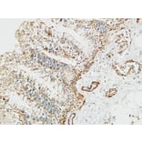 Immunohistochemistry - Anti-PTX3 Antibody (C10482) - Antibodies.com