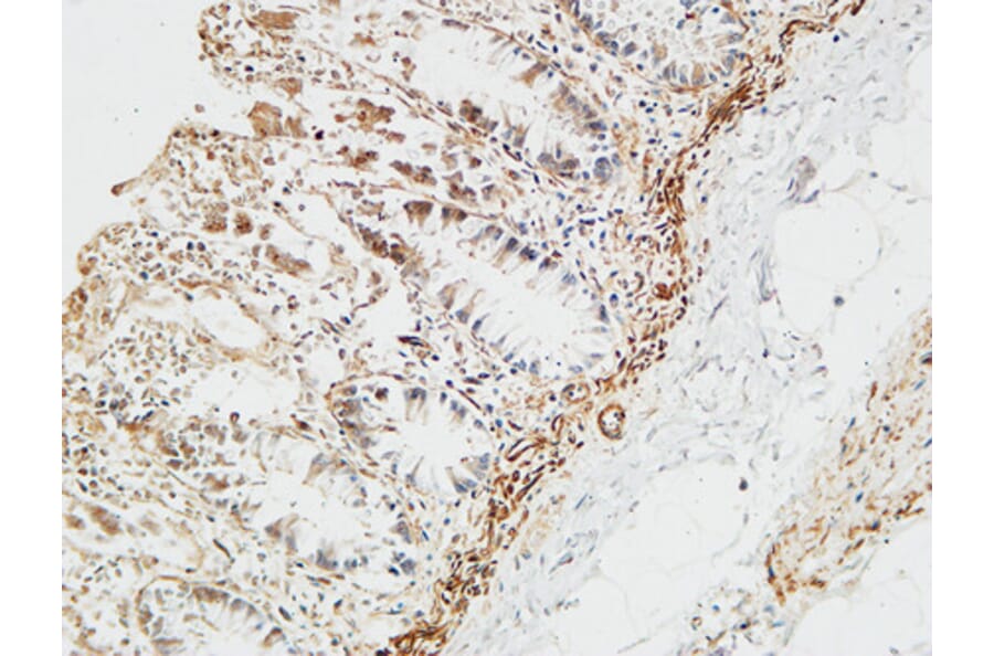 Immunohistochemistry - Anti-PTX3 Antibody (C10482) - Antibodies.com